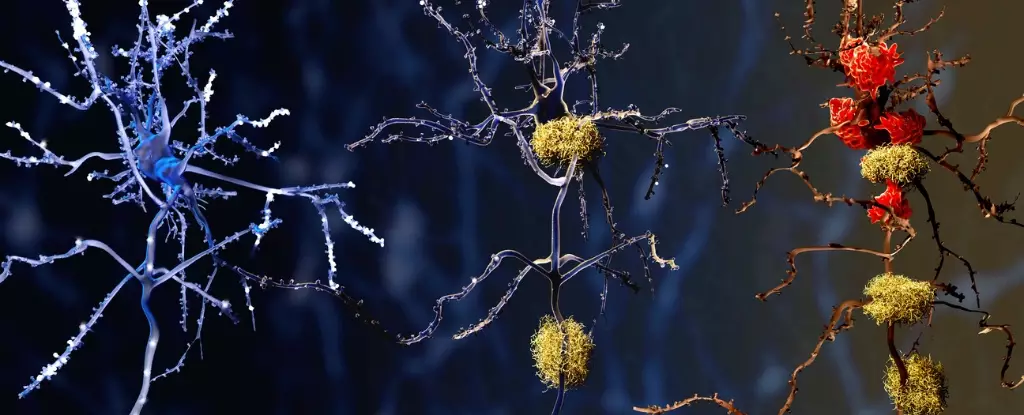 Examining the Impact of Microglia on Alzheimer’s Disease Progression