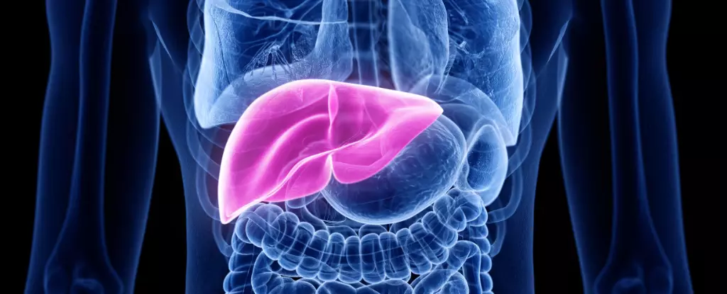 Revolutionizing Bowel Cancer Treatment: The Case of Liver Transplantation