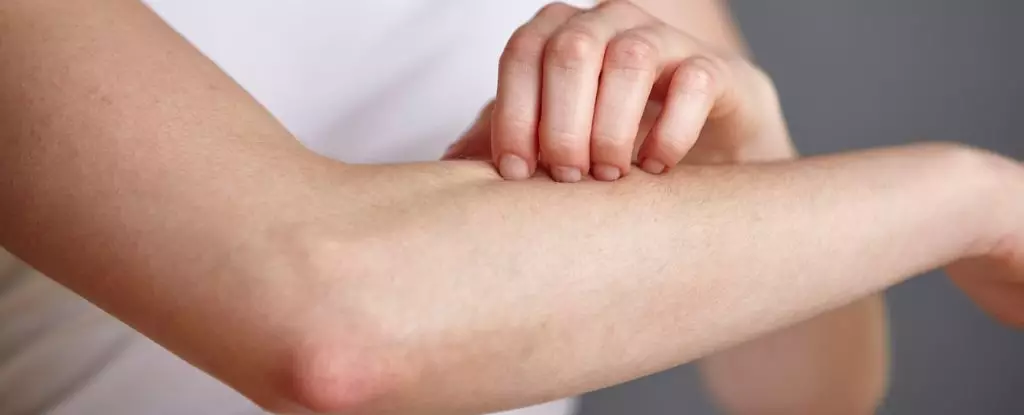 Uncovering Skin’s Secret Weapon Against Superbugs