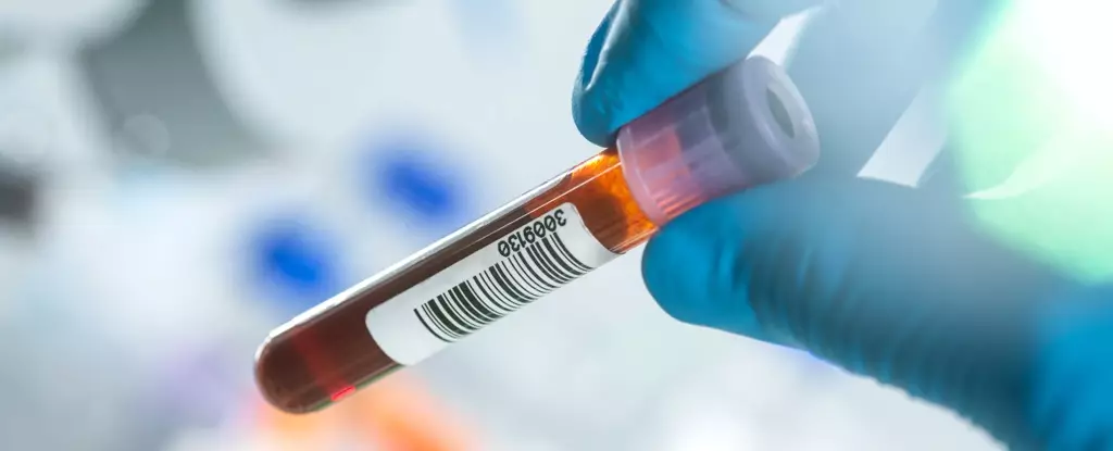 Revolutionary Blood Test Offers Hope in the Fight Against Alzheimer’s