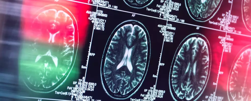 Revolutionizing Alzheimer’s Research: Why an Immune System Perspective Could Unlock the Cure