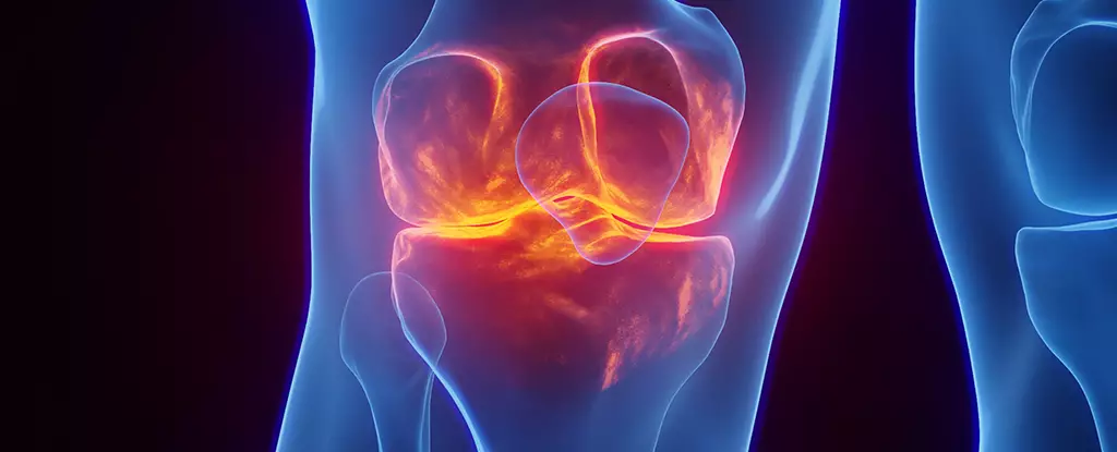 Unlocking the Truth Behind Noisy Knees: Embrace Movement with Confidence