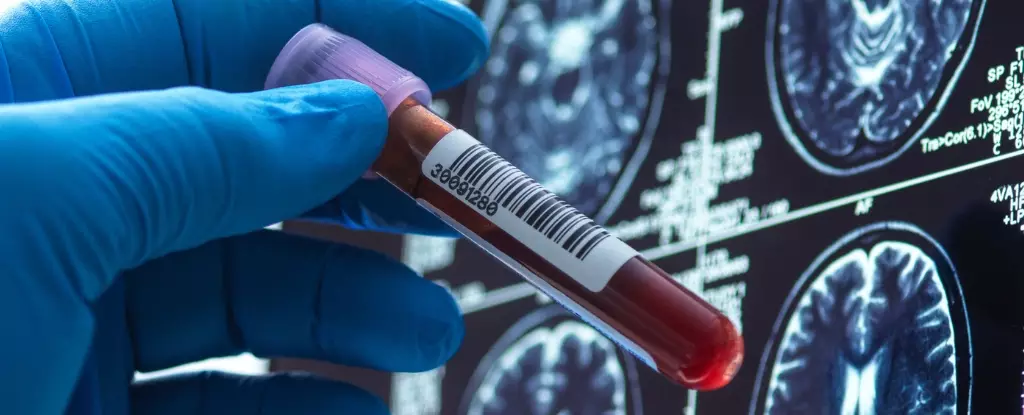 Revolutionizing Alzheimer’s Care: Hope, Challenges, and the Path Forward
